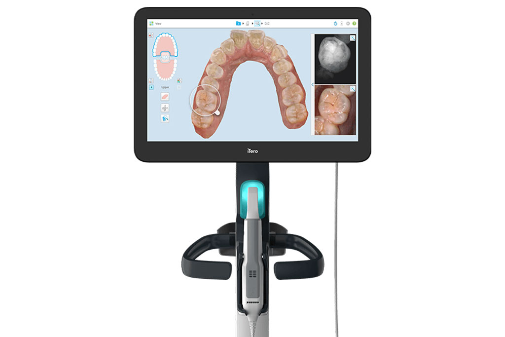 iTeroエレメント 5Ｄプラス